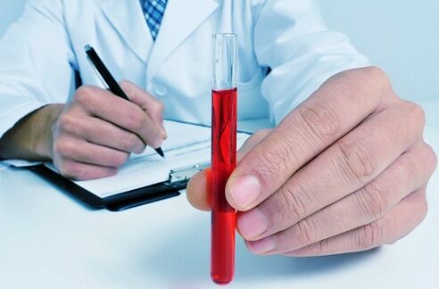 test krvi za identifikaciju parazita