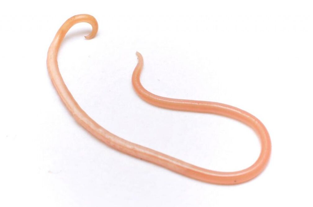 parazitski crv iz ljudskog tijela