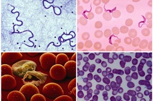 kakvi paraziti mogu biti u ljudskoj krvi